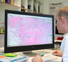 Philips Signs Agreement to Create Taiwan's First Fully Digitalized Pathology Department