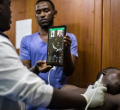 Philips Partners With PURE on Tele-Ultrasound Program for Physicians in Rwanda