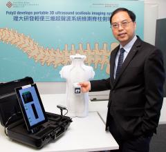 Hong Kong Polytechnic University Develops Palm-sized 3-D Scoliosis Ultrasound Imaging System