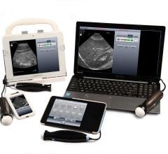 Ultrasound Technology, USB probes, MobiUS PE, MobiUS TC2, UltraLinq