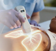Qure.ai Receives Grant to Build AI-Powered Point-of-Care Ultrasound