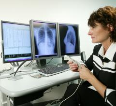chest X-ray, radiographs, ebola, Emory University Hospital