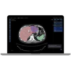 Raidium Debuts New AI-Native PACS Viewer