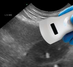 Wireless handheld ultrasound equipment brings diagnostic imaging to patients regardless of location 