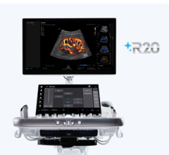Samsung to Introduce New Ultrasound System at RSNA 2025