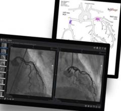 The rapidly deployed PICOM365 Cloud solution provides the Huntsville, Texas hospital enterprise imaging workflow for Cardiology including ECG, Radiology including 3D Tomo, and advanced Teleradiology for third party diagnostics.