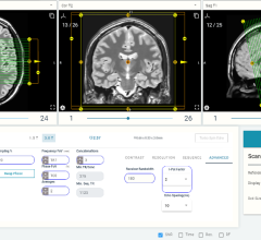 MRI simulation software leader ScanLabMR announced the release of UltraLab