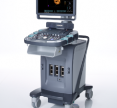 Siemens Acuson X600 Ultrasound System Adds to X Family 