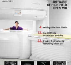Hitachi Healthcare Highlights Benefits of High-Field Open MRI in New Supplement