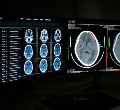 Imaging Artificial Intelligence (AI) provider Qure.ai announced its first US FDA 510(k) clearance for its head CT scan product qER. The US Food and Drug Administration's decision covers four critical abnormalities identified by Qure.ai's emergency room product.