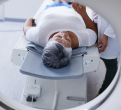 A patient implanted with the Axonics System can undergo MRI examinations safely with radio frequency (RF) Transmit Body or Head Coil under the conditions outlined in the Axonics MRI Conditional Guidelines.