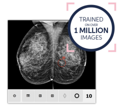 Diagnostic Centers of America (DCA), Boca Radiology Group and ScreenPoint Medical, Inc., announce strategic partnership to improve early detection using artificial intelligence in mammography