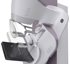 Candelis, Inc., a leading provider of innovative and cost-effective enterprise healthcare solutions, and GE Healthcare, the healthcare business unit of General Electric, have announced a collaboration to enhance the mammography workflow, image management, and storage capabilities for the Senographe Pristina Mammography System