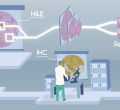 Published in Nature Communications, ReceptorNet is a breakthrough deep-learning algorithm that can determine hormone-receptor status - a crucial biomarker for clinicians when deciding on the appropriate treatment path for breast cancer treatment