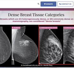 DB-I website features new educational tools and streamlined user experience to improve access to medically sourced breast density content