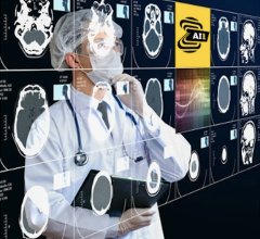 Nanox enters into acquisition via merger agreement with Zebra Medical Vision Ltd. and announces entry into binding letter of intent with USARAD Holdings Inc. with the goal of creating an integrated, globally connected end-to-end radiology solution and population preventive health platform