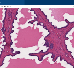 Proscia, a leader in digital and computational pathology solutions, and Hamamatsu Photonics K.K., a leading provider of whole slide imaging systems, announced a collaboration to accelerate digital pathology adoption at an enterprise scale.