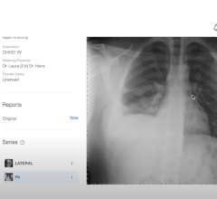 Patient-centric medical image sharing platform PocketHealth announced the launch of Report Reader. 
