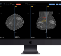 Fostering global excellence in diagnostic accuracy, DetectedX and GE Healthcare have entered into an educational partnership to expand access to the Radiology Online Learning Platform from DetectedX. 
