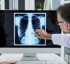 The radiology online learning platform from DetectedX has shown a 34% improvement in the accuracy of diagnosing difficult cases