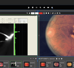 arcc v10.7, Apollo’s newest Enterprise Imaging platform release, enhances a side-by-side clinical image comparison mode to streamline clinical workflow 