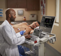 New Ultrasound Compact System 5000 Series delivers premium image quality needed to aid in a confident diagnosis in a portable unit 