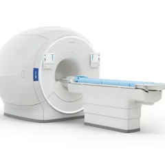 Philips’ Xenon enabled MRI combined with XENOVIEW from Polarean can provide pulmonologists, surgeons and respiratory specialists with regional maps of ventilation in patients’ lungs to assist in better managing disease states 