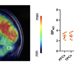 A new PET radiotracer that visualizes the enzyme primarily responsible for metabolic cholesterol degradation in the brain has been successfully validated
