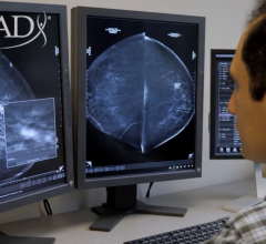 Company’s ROI Tool offers preview of business value the ProFound Breast AI Suite offers to clinicians and imaging facilities