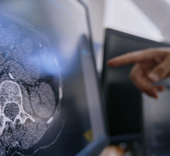At ECR23, Median will unveil the latest developments for eyonis alongside its AI-powered clinical trial imaging services