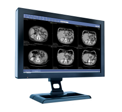 At the Radiological Society of North America’s 2022 annual meeting (RSNA), international medical imaging and cybersecurity company Sectra will showcase solutions that help radiologists tackle workload challenges. 
