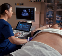 The Acuson Sequoia with Deep Abdominal Transducer (DAX) scanning a 600 pound patient.