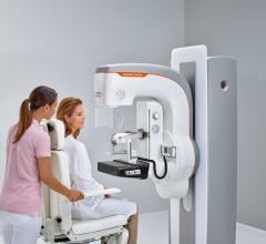Discomfort May Deter Large Number of Women From Obtaining Mammograms