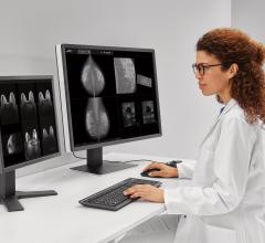 Siemens Healthineers has announced the U.S. Food and Drug Administration (FDA) clearance of two new mammography reading and workflow optimization solutions that expand the company’s offerings for breast health.