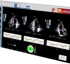 Ebit and DiA Imaging Analysis Partner on AI-based Cardiac Ultrasound Analysis