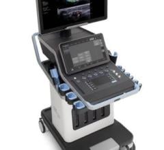 Hologic, Inc. announced he U.S. launch of the SuperSonic MACH 40 ultrasound system, expanding the company’s suite of ultrasound technologies with its first premium, cart-based system. 