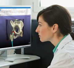 Synopsys Releases Simpleware ScanIP Medical Software for 3-D Printing
