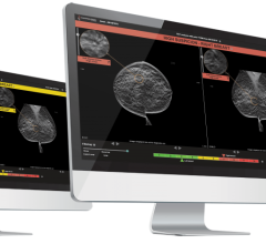 For the first time, an AI-based decision support software for breast cancer detection uses patient’s prior exams to refine its prediction of malignancy
