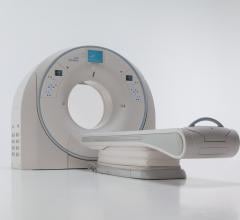 Canon Aquilion One CT Helps Gates Vascular Institute Adhere to New Stroke Guidelines