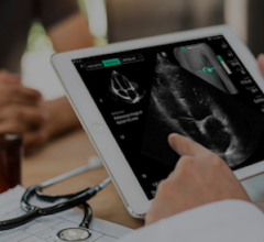 UltraSight, Jefferson Health Partner to Expand Access to Cardiac Imaging