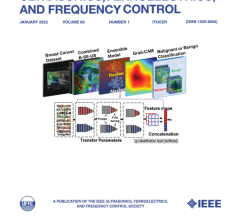 The study published as the front-page cover paper of the January issue of IEEE Transactions on Ultrasonics, Ferroelectrics, and Frequency Control.​​​​​​​ Image courtesy of POSTECH