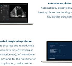 EchoGo uses artificial intelligence (AI) to calculate cardiac ultrasound left ventricular ejection fraction (EF), the most frequently used measurement of heart function, left ventricular volumes (LV) and, for the first time for an AI application, automated cardiac strain.