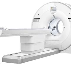 United Imaging Announces First U.S. Clinical Install of uMI 550 Digital PET/CT System