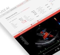 Us2.ai, a Singapore-based medtech firm backed by Sequoia India and EDBI, has received U.S. Food and Drug Administration (FDA) clearance for Us2.v1, a completely automated AI decision support tool for cardiac ultrasound.