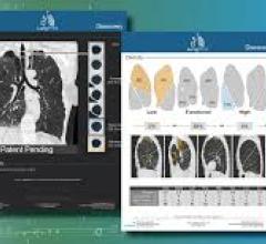 LungPrint Discovery offers fully automatic radiological metrics and unique, time-saving airway visualizations
