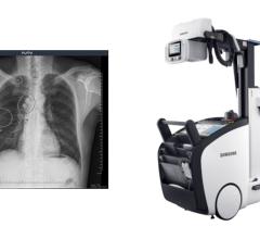 VUNO’s road-tested, clinically-proven chest X-ray detection software is reshaping the delivery of medical imaging diagnostics by being fully integrated with Samsung Electronics’ X-ray system