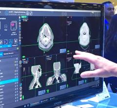 MD Anderson and Varian Partner to Optimize Radiation Oncology Treatment