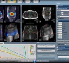 FDA Clears MRI-Guided Radiation Therapy System