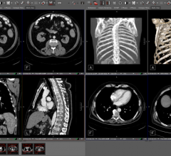 Visage 7 Live Connect enables simple radiologist collaboration with referrers