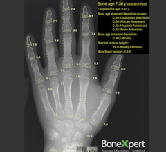 Pediatric Bone Imaging Software Gets FDA Nod